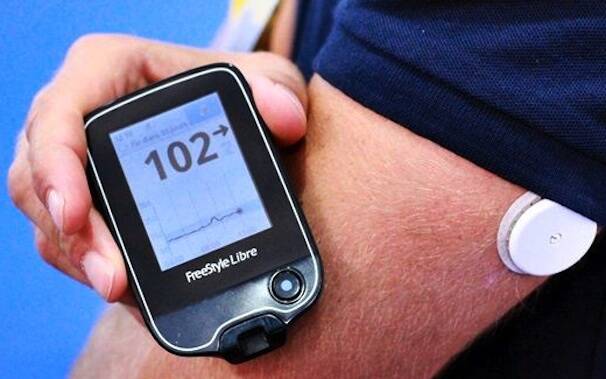 Diabete monitoraggio flash