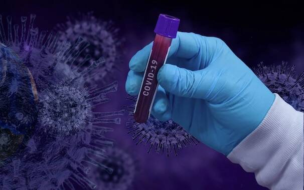 Coronavirus test analisi