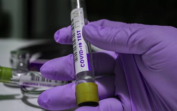 Coronavirus test negativo