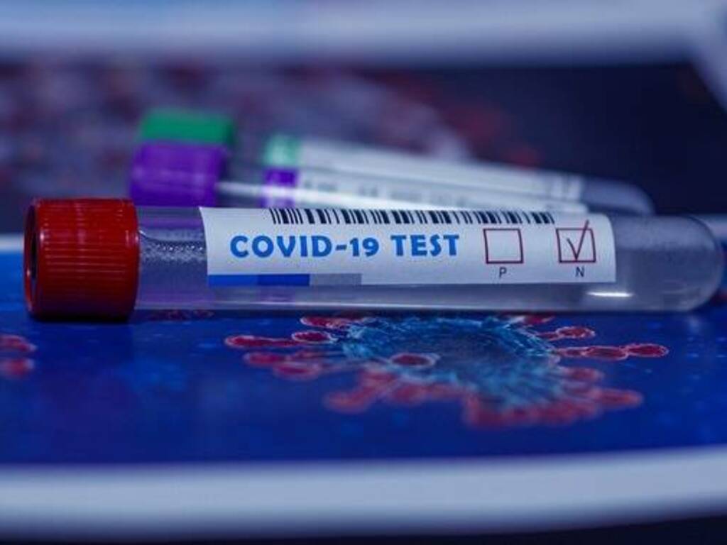 Covid test coronavirus negativo